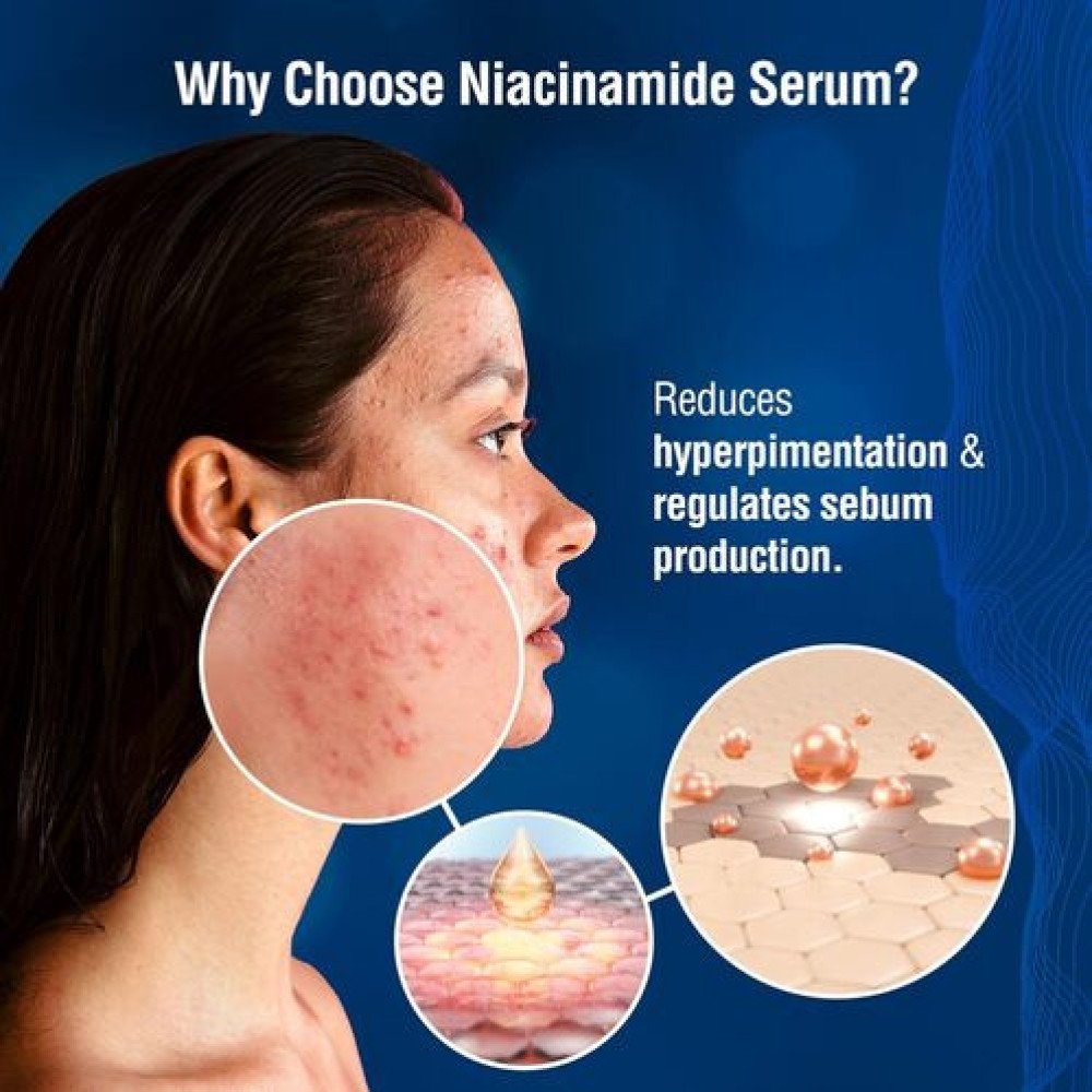 DERMDOC  for Clear Skin | 2% Salicylic Acid Face Serum (15 ml) oily skin  blackheads, whiteheads acne prone skin-15ml