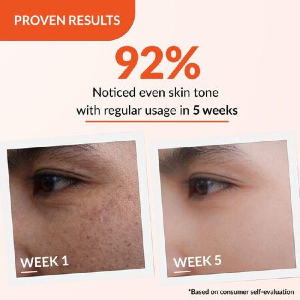 Fixderma Tranexamic Acid + 2% Kojic Acid + 1% Arbutin SKARFIX -TX Face Cream | Pigmentation Removal Cream | Kojic Acid | Uneven Skin Tone - 15 gm