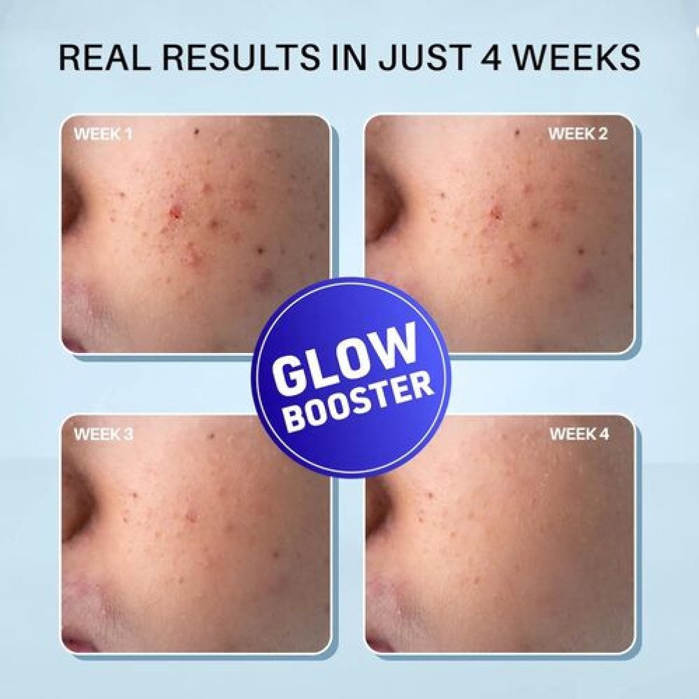 DERMDOC 2% Kojic Acid Night Cream  With Niacinamide  Alpha Arbutin | Face Moisturizer For Glowing & Brightening Skin | Reduces Dark Spots -50 Gm